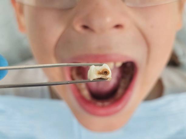 Best Emergency Dental Care for Trauma or Injury in San Felipe, TX